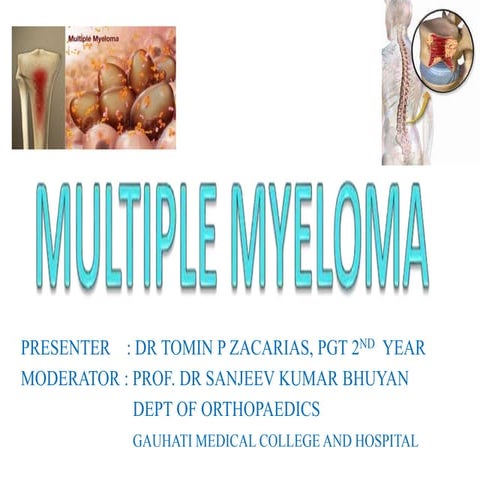 Multiple myeloma and its management