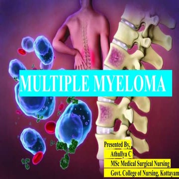 multiple myeloma important condition to note