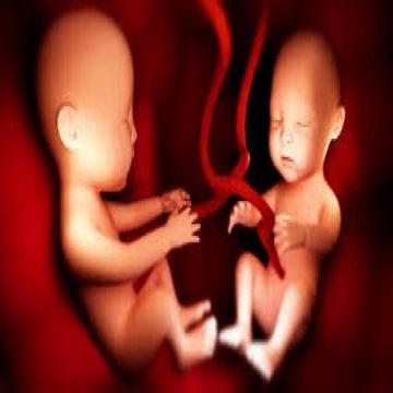 Multiple pregnancy | PPTX
