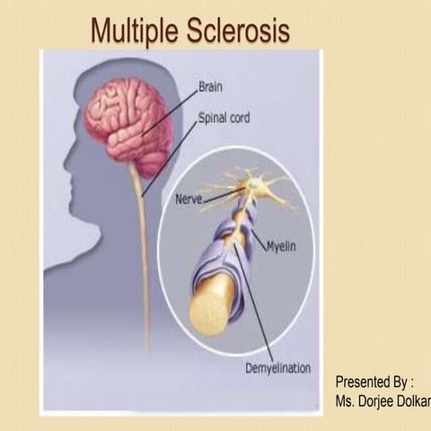 Multiple sclerosis and mysthenia gravis