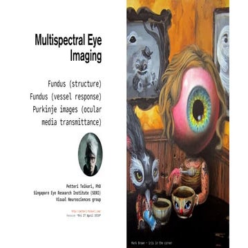 Portable Multispectral Fundus Camera