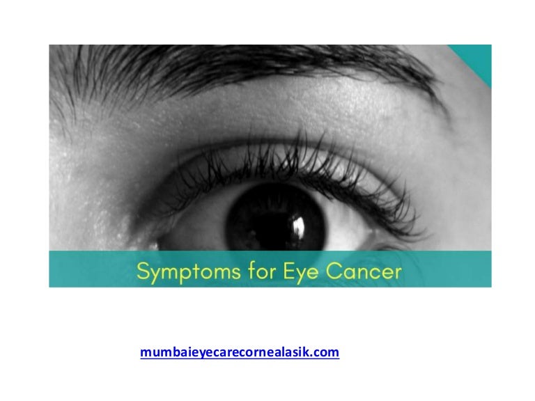 Symptoms of Eye Cancer