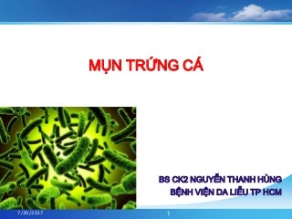 MỤN TRỨNG CÁ