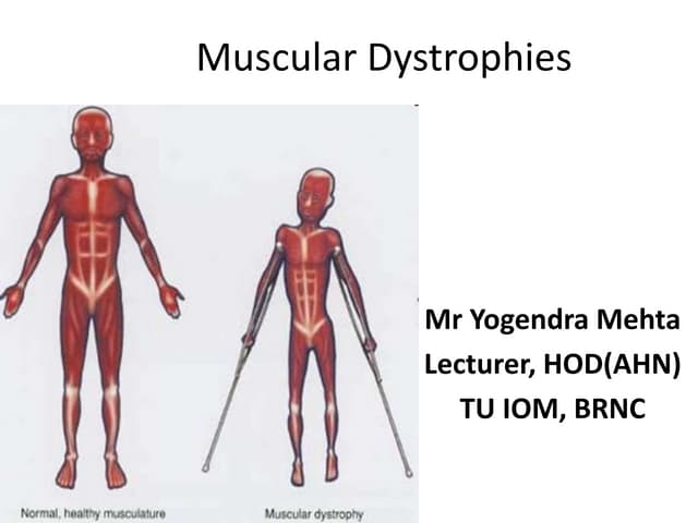 Muscular dystrophy | PPTX