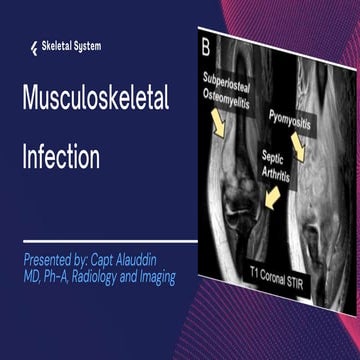 Musculoskeletal infection by capt alauddin.pptx