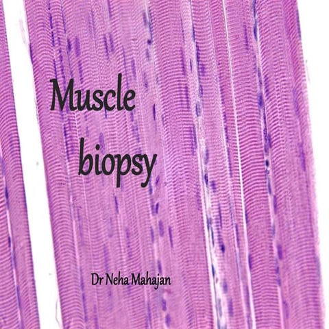 Musle biopsy