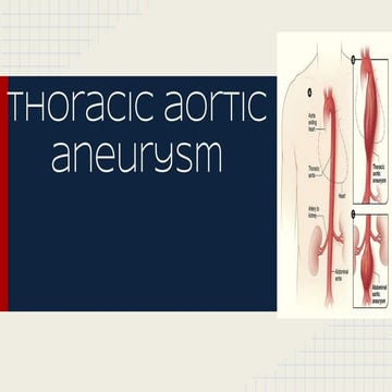 Thoracic aortic aneurysm | PPTX