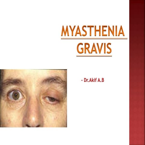 Myasthenia gravis