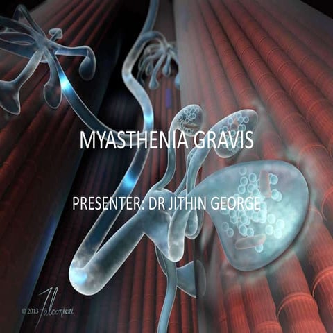 Myasthenia gravis  