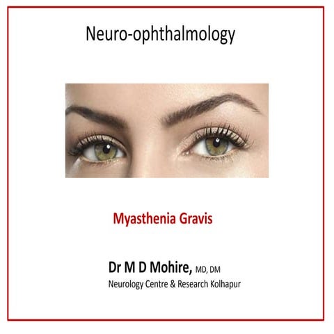 Myasthenia gravis teaching..Dr M D Mohire, Kolhapur,Maharashtra