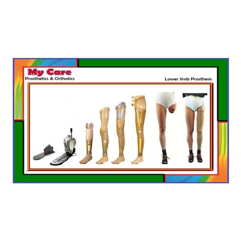 Caliper shoes for polio patients @ My Care Prosthetics and Orthotics | PDF
