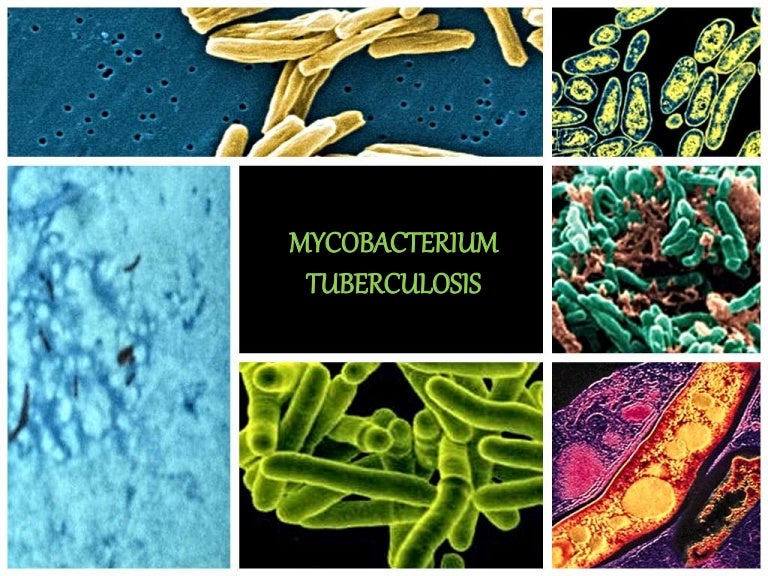 Mycobacterium tuberculosis(Microbiology)