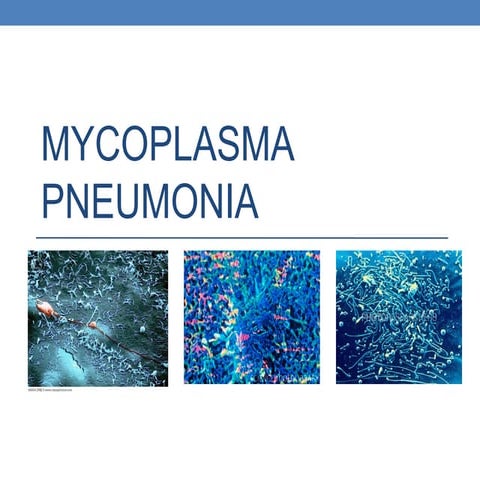 Mycoplasma Pneumonia | PPT