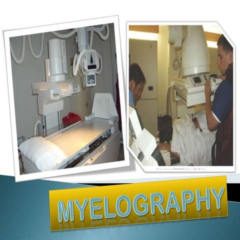 Myelography
