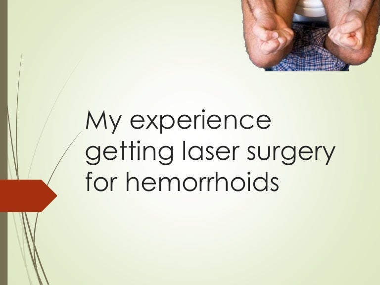 My experience getting laser surgery for hemorrhoids