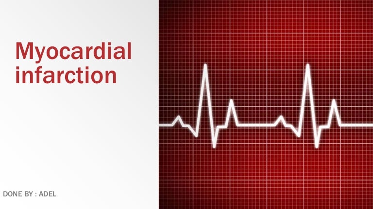 what is a myocardial infarction what is a myocardial infarction