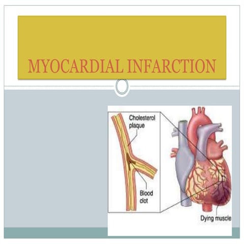 Myocardial infarction