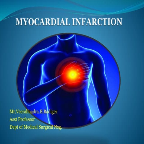 Myocardial infarction