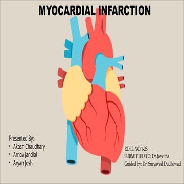 pathophysiology of myocardial infarction | PPTX