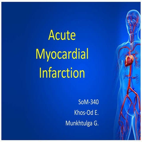Acute Myocardial infarction