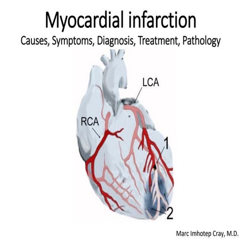 Myocardial infarction_ Causes, Symptoms, Diagnosis, Treatment, and Pathology