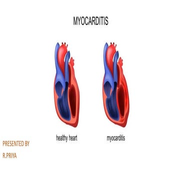 Myocarditis