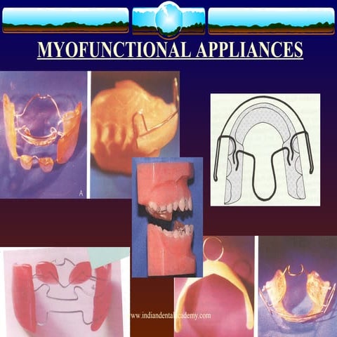 Myofunctional appliances 