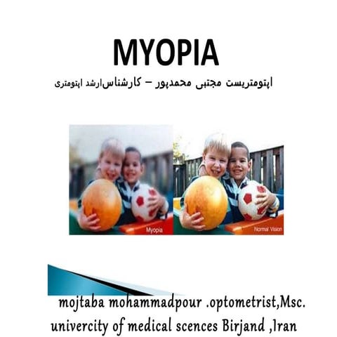 Myopia