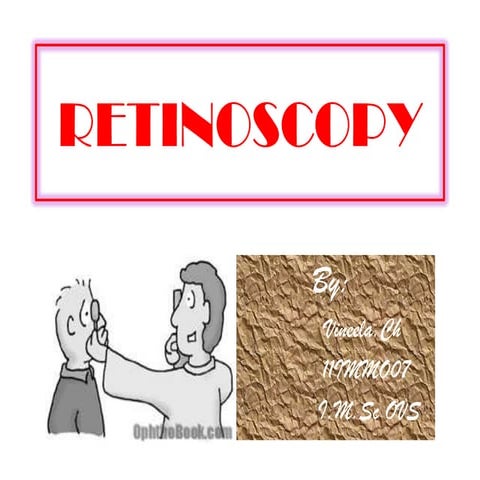 Retinoscopy By Vineela.Che