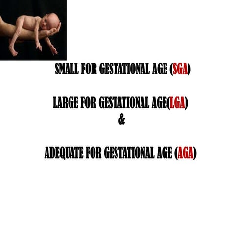 SMALL FOR GESTATIONAL AGE,LARGE FOR GESTATIONAL AGE -SSJ, CALICUT MEDICAL COL...