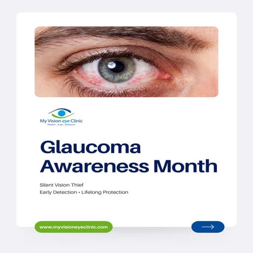 What is Glaucoma - The Silent Thief of Sight | PDF