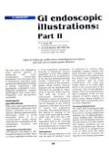 GI Endoscopic Illustrations Part-II - Sanjoy Sanyal