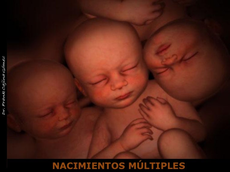 Nacimiento múltiple 11may11