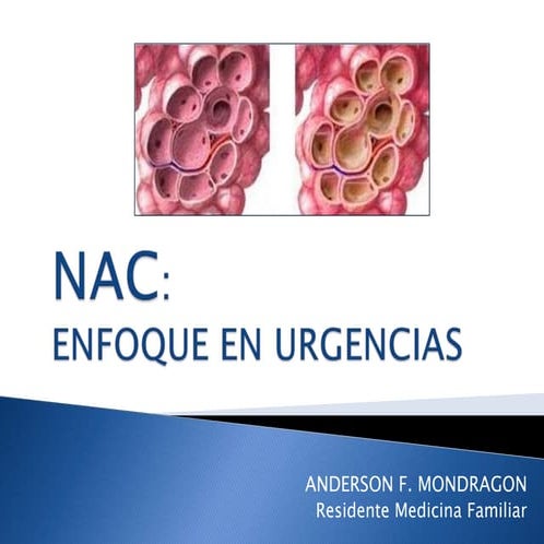 Nac urgencias