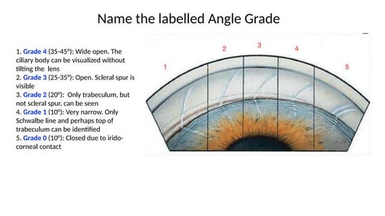 Name the labelled structures - Color Coding for retinal illustration.pptx