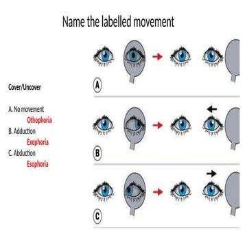 Name the labelled movement - Cover:Uncover test.pptx