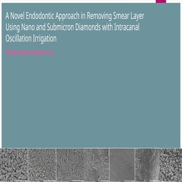 New Technique for Smear Layer Removal in Endodontics