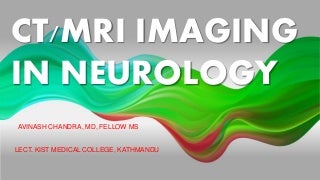 'mri' on SlideShare