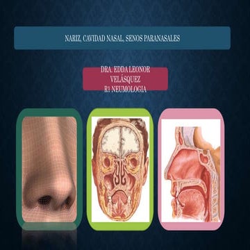 Nariz, cavidad nasal y senos paranasales