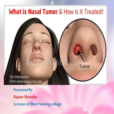 Nasal tumors