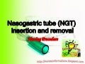 Nasogastric Tube (NGT) insertion and removal
