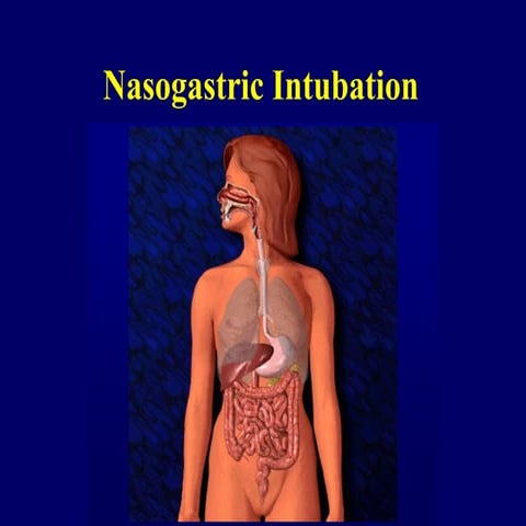 Nasogastric intubation