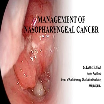 Nasopharyngeal carcinoma management principles