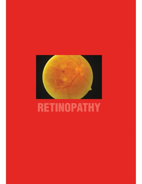 Synergizing Efforts in Diabetes Care at the Tertiary Level