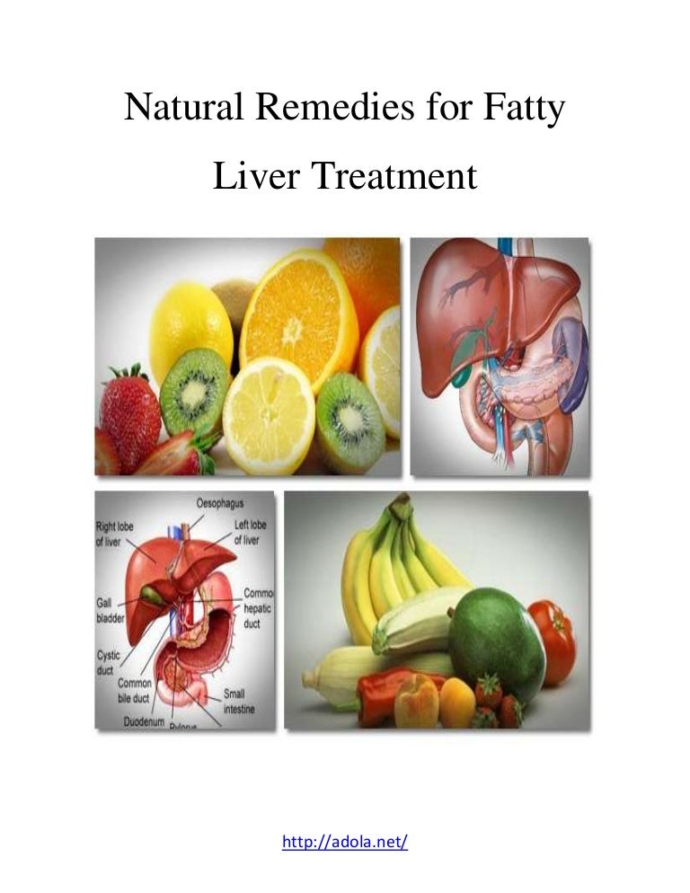 Natural remedies for fatty liver treatment