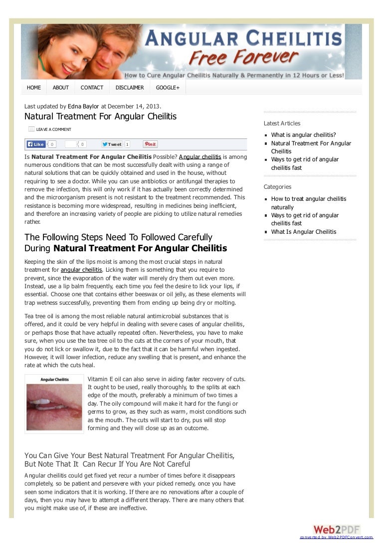 Treatment for Angular Cheilitis