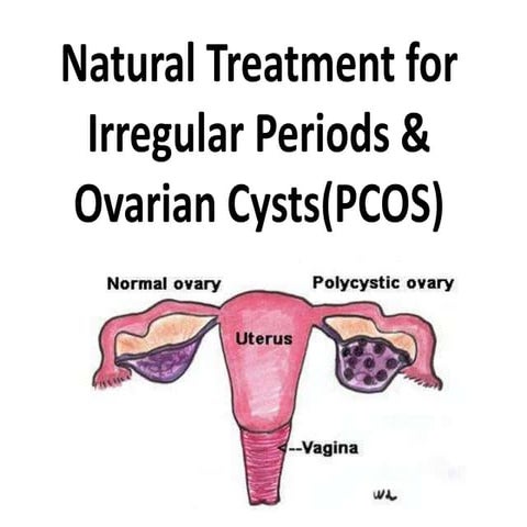 Natural treatment for irregular periods,overian cysts & pcos | PPTX
