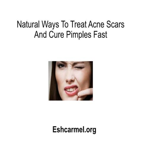 Natural ways to treat acne scars and cure