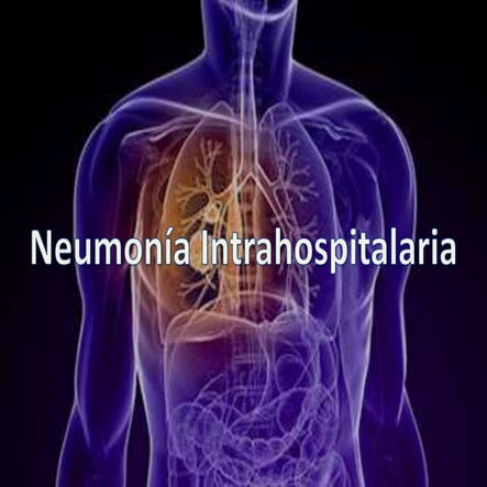 Neumonía Intrahospitalaria y asociada a ventilacion mecánica