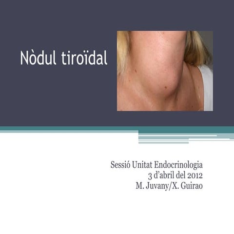 Nòdul tiroïdal